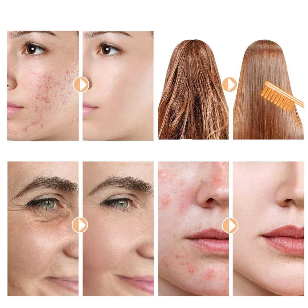 Advanced Skin Tightening Facial Wand