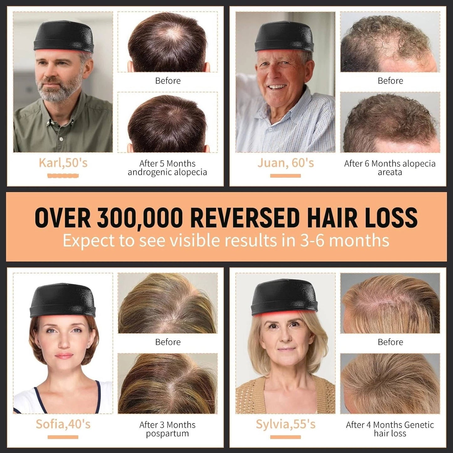 Clinical Strength Hair Regrowth Cap - Red Light Therapy