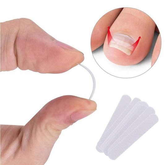 Toenail Care Correction Clip Set 10 Pack - Pexav