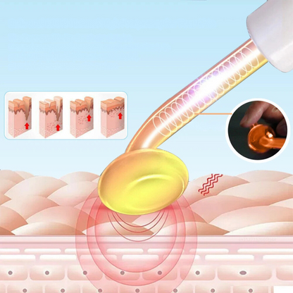 Advanced Skin Tightening Facial Wand