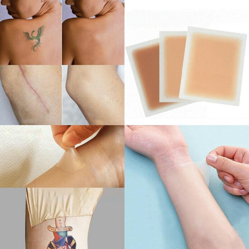 Skin Tone Scar Cover Up Medical Tape 6PCS - Pexav
