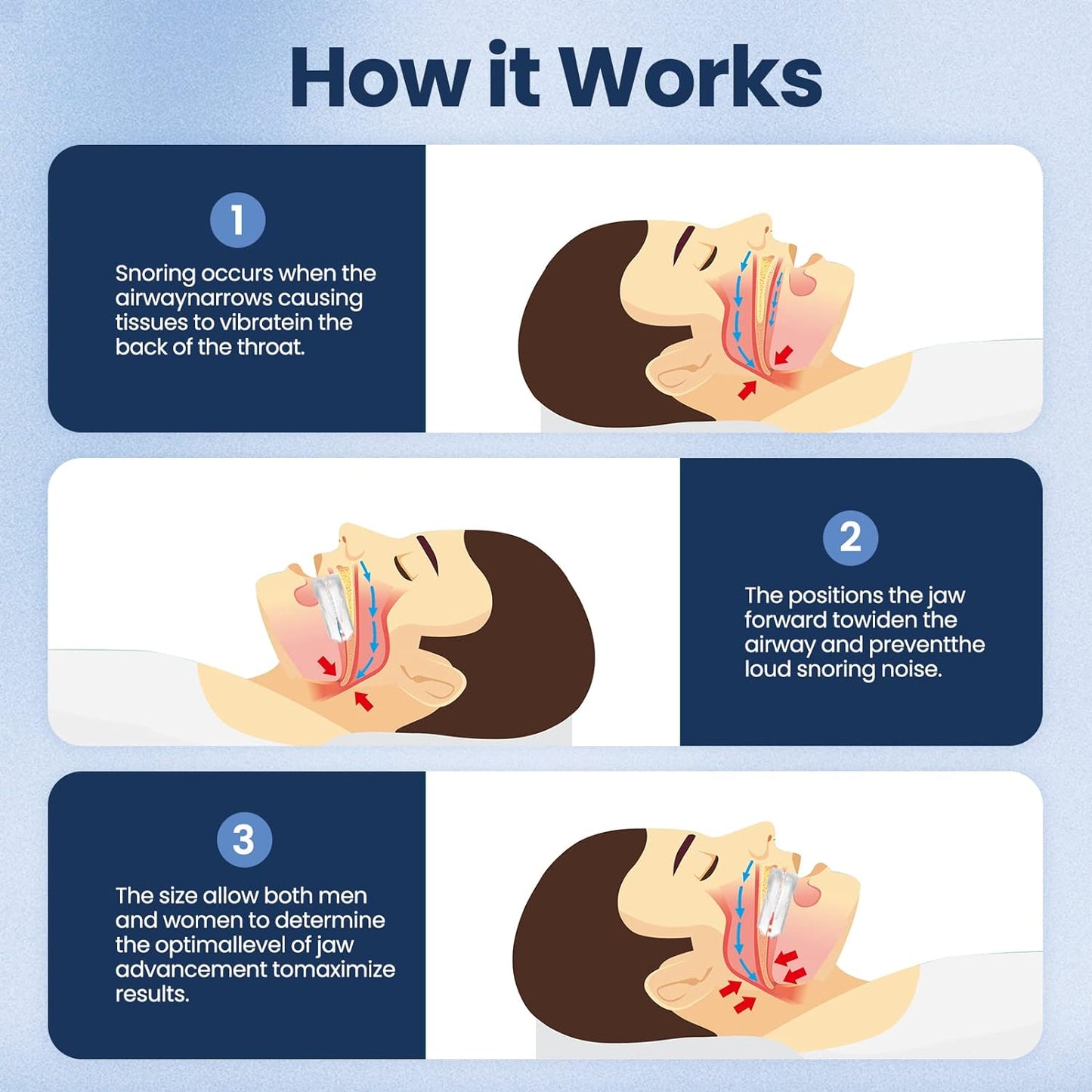 Snore Stopping Mouth Guard for Better Sleep