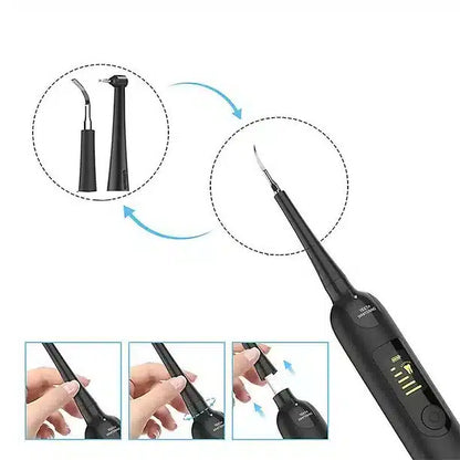 Advanced Dental Plaque Removal Kit