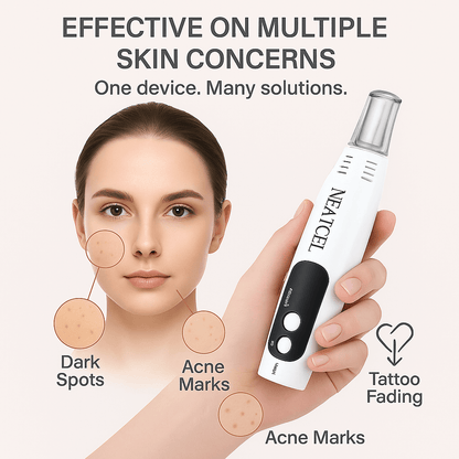 Fast Dark Spot Corrector Laser Pen Treatment