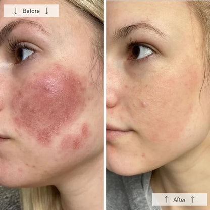 Advanced LED Face Mask for Skin Renewal