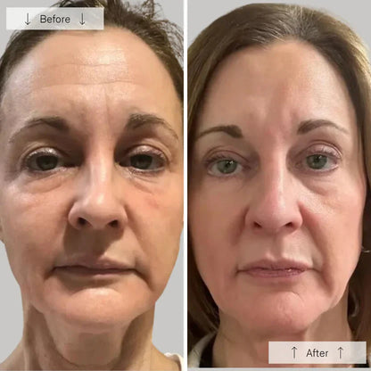 Advanced LED Face Mask for Skin Renewal