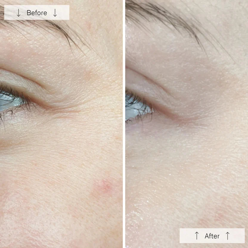 Advanced LED Face Mask for Skin Renewal