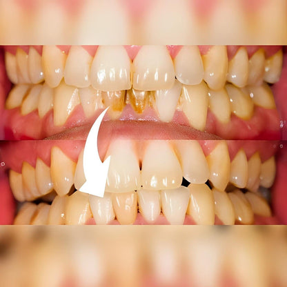 Advanced Oral Care Plaque Remover