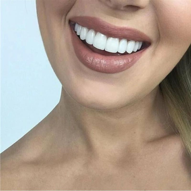 Comfort Fit Snap Denture