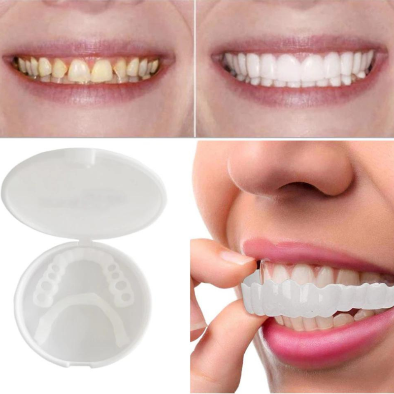 Comfort Fit Snap Denture