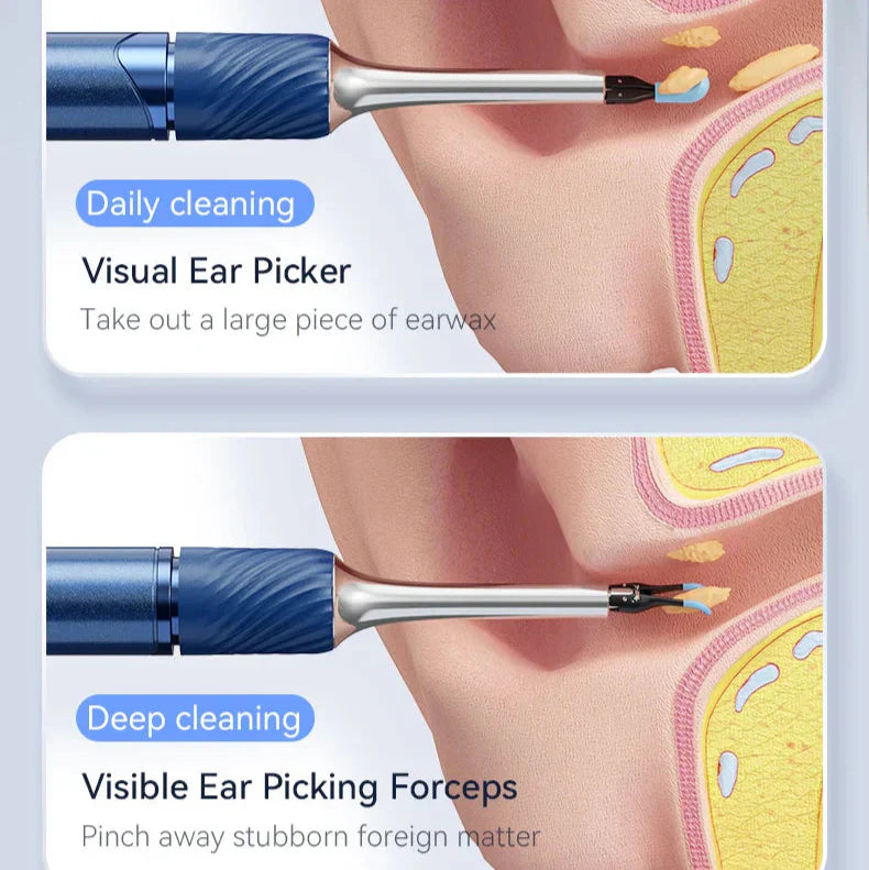 Wireless Ear Cleaner with HD Camera