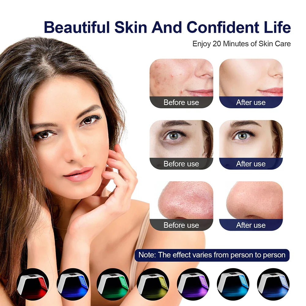 Advanced Portable LED Face Mask - 7 Settings