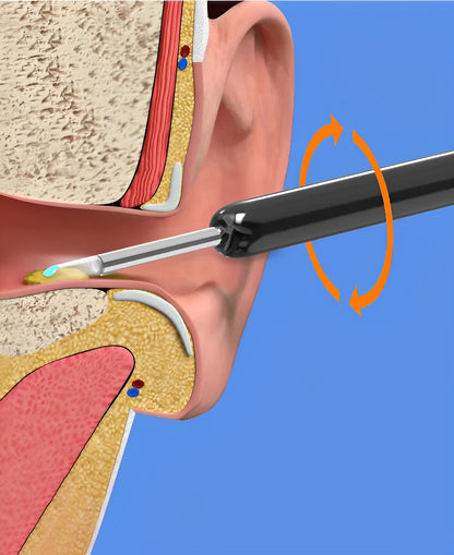 Wireless Ear Scope Cleaner with LED Camera