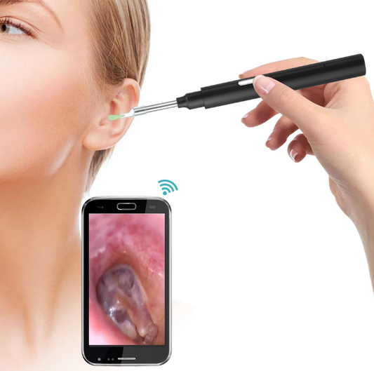 Wireless Ear Cleaning Camera 3MP Waterproof LED Light - Pexav
