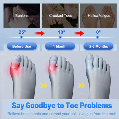 Comfortable Toe Spacer Corrector with Soft Breathable Support