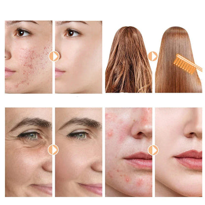 Advanced Skin Tightening Facial Wand