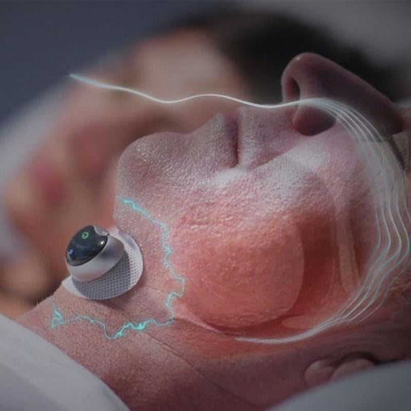 Snore Stopper Sleep Aid Device for Peaceful Rest - Pexav
