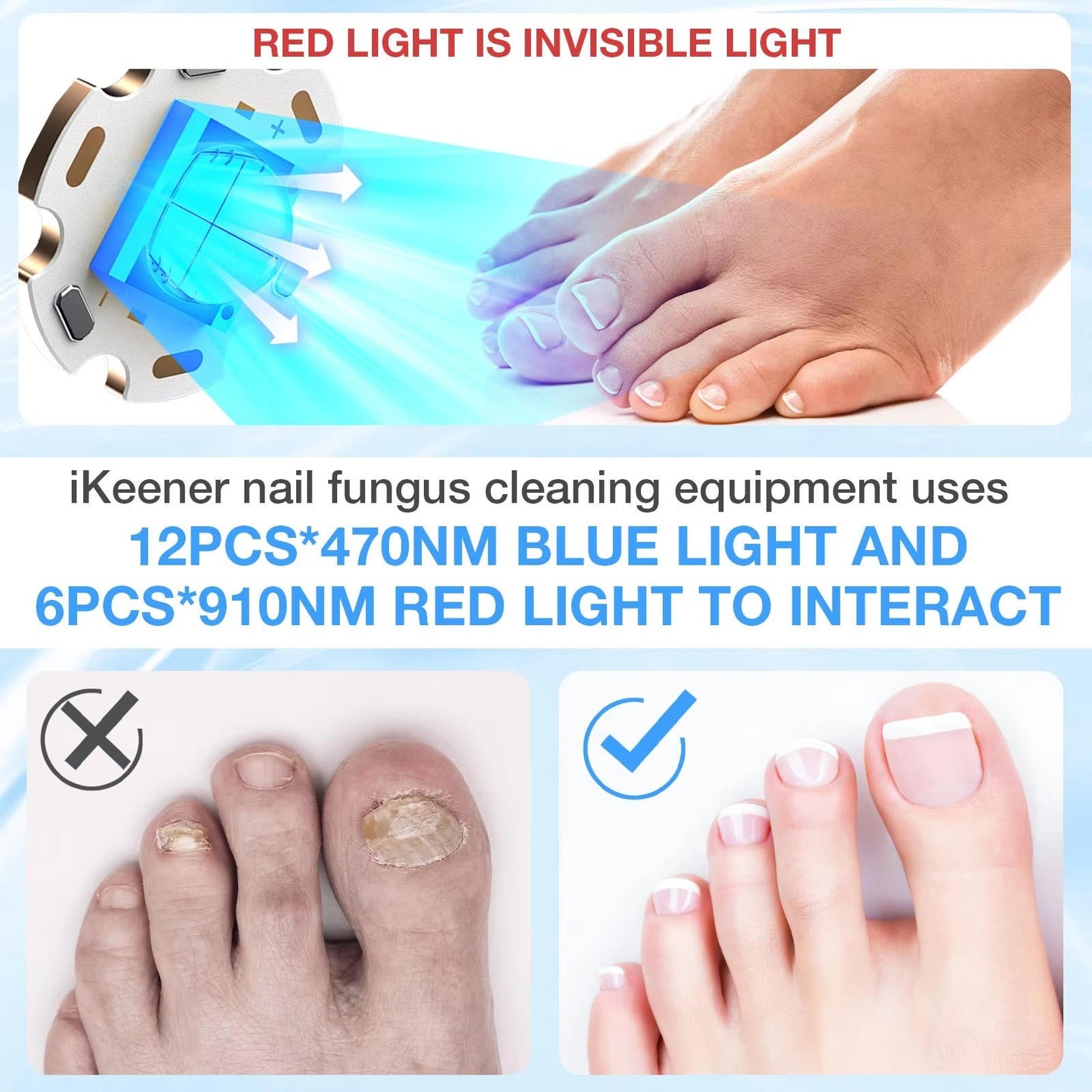 Effective Toenail Fungus Treatment Laser