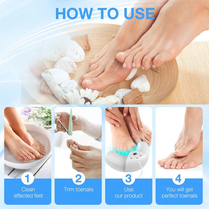 Effective Toenail Fungus Treatment Laser