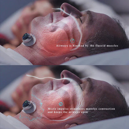 Sleep Aid Snore Stopper with Magnetic Therapy