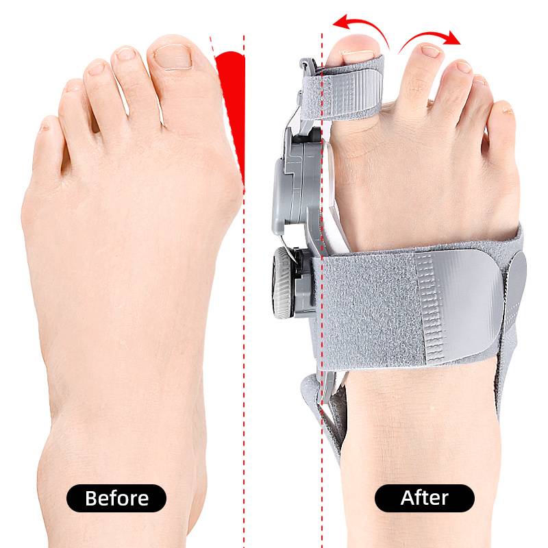Comfortable Bunion Relief Toe Separators