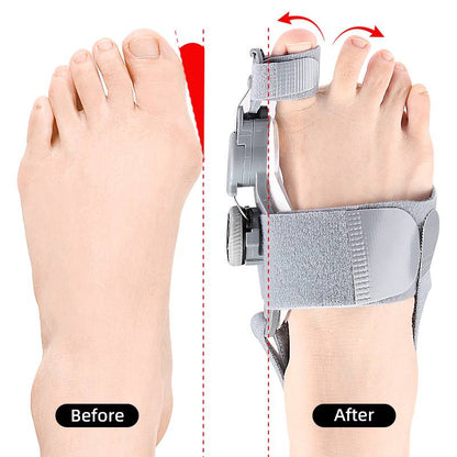 Comfortable Bunion Relief Toe Separators