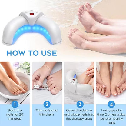 Effective Toenail Fungus Treatment Laser