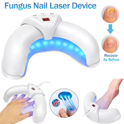 Effective Toenail Fungus Treatment Laser