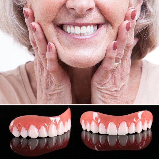 At Home Teeth Veneer Kit Easy Smile Makeover - Pexav