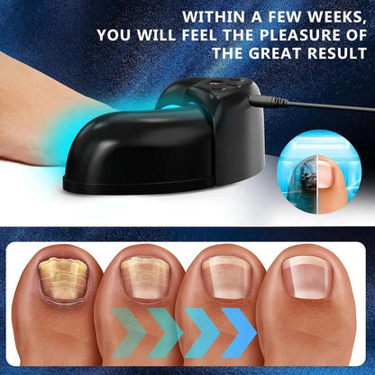Effective Toenail Fungus Treatment Laser