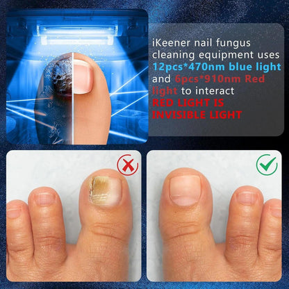 Effective Toenail Fungus Treatment Laser
