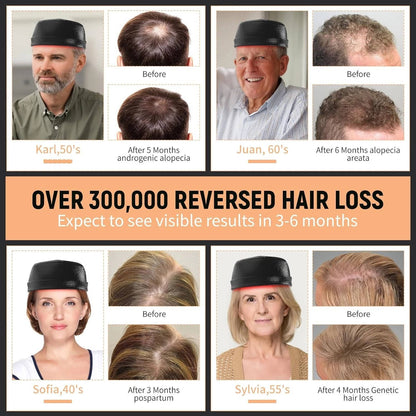 Clinical Strength Hair Regrowth Cap - Red Light Therapy