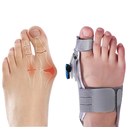 Comfortable Bunion Relief Toe Separators - Pexav