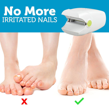 Effective Nail Fungus Removal Laser Treatment Device